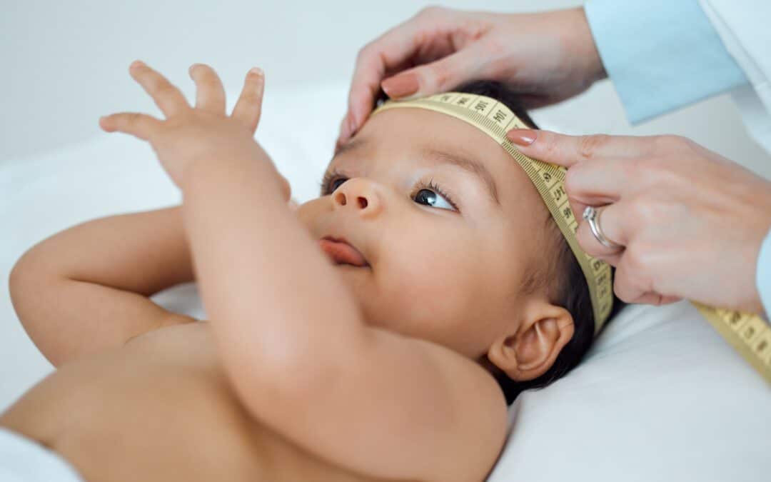 What is Plagiocephaly? How it affects infants?