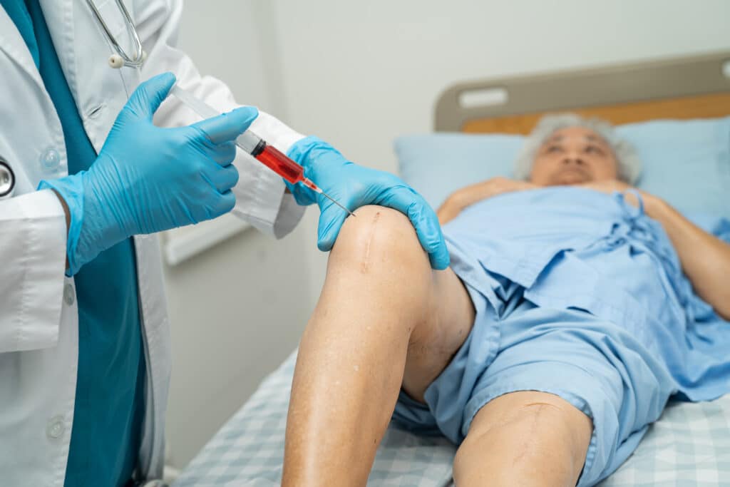 PRP for Arthritic Knees: Your Path to Pain-Free Mobility with Knee Platelet-Rich Plasma Treatment