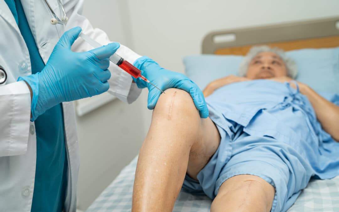 PRP for Arthritic Knees: Your Path to Pain-Free Mobility with Knee Platelet-Rich Plasma Treatment